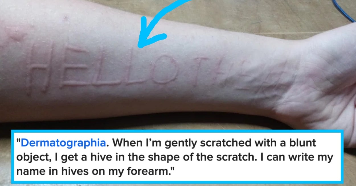 I Had No Idea The "Unusual" Thing My Body Did Was, In Fact, Not "Normal," And I Feel So Validated By These 32 People Who Had The Same Experience