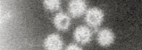 ノロウイルスの電子顕微鏡写真。［埼玉県衛生研究所提供］（時事通信）