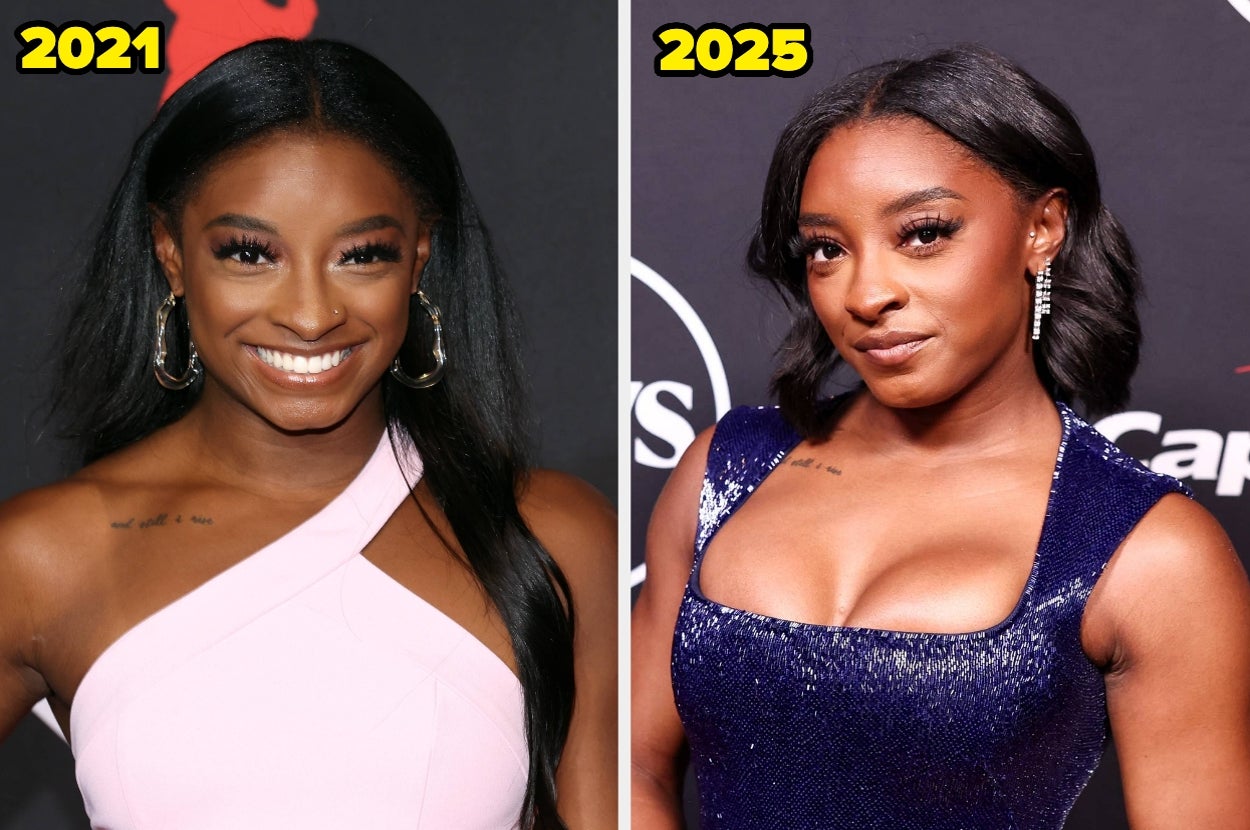 Simone Biles Just Got Brutally Honest About Her Boob Job And Eye-Bag Surgery, And The Reason Why Is Actually Pretty Admirable