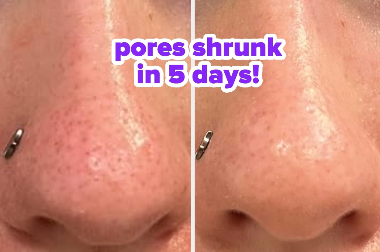 32 Products With Results So Remarkable, You’ll Blink Your Eyes In Disbelief