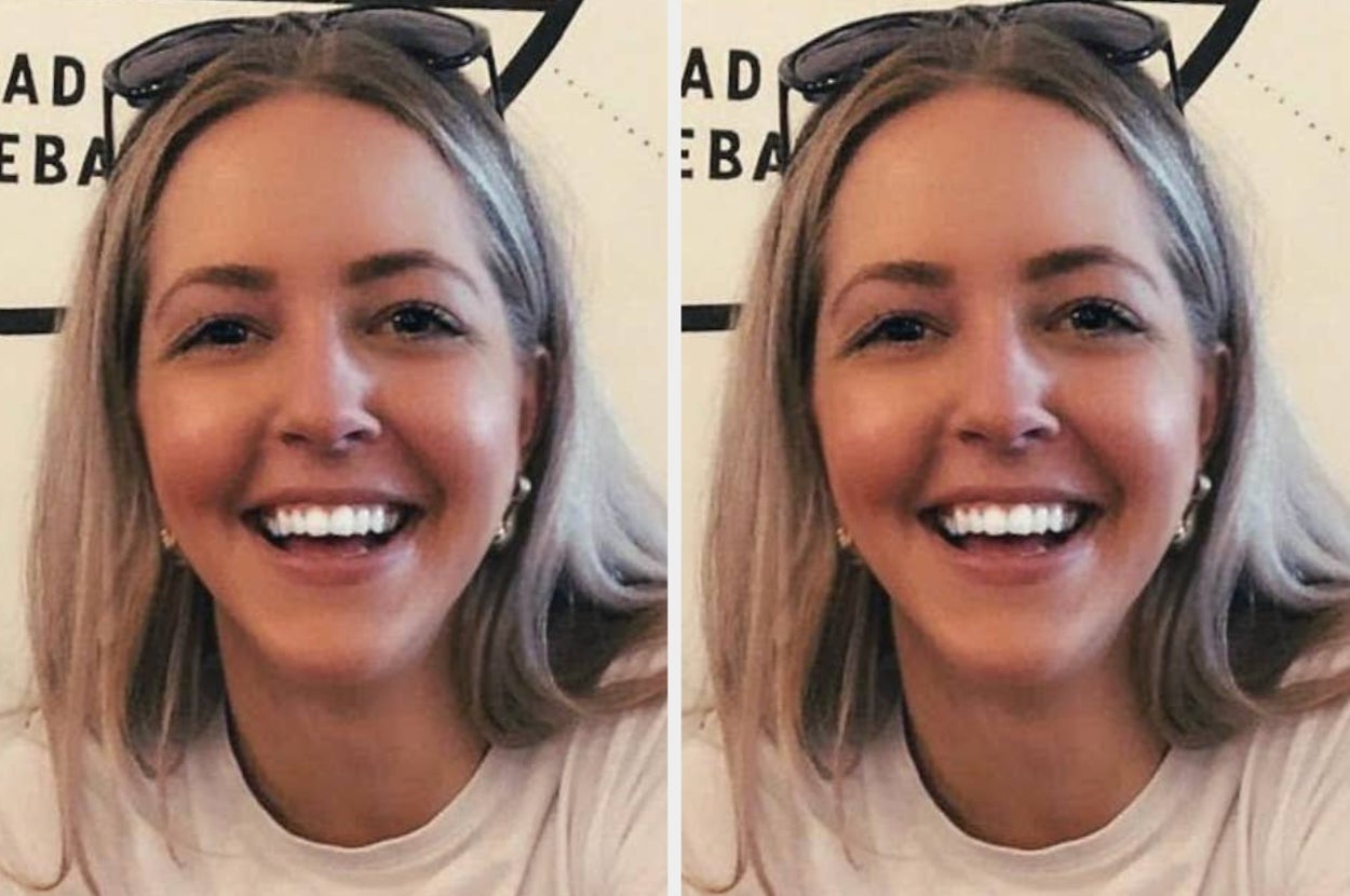 I Took My Appearance For Granted. Then My Face Changed — And My Life Transformed Overnight.