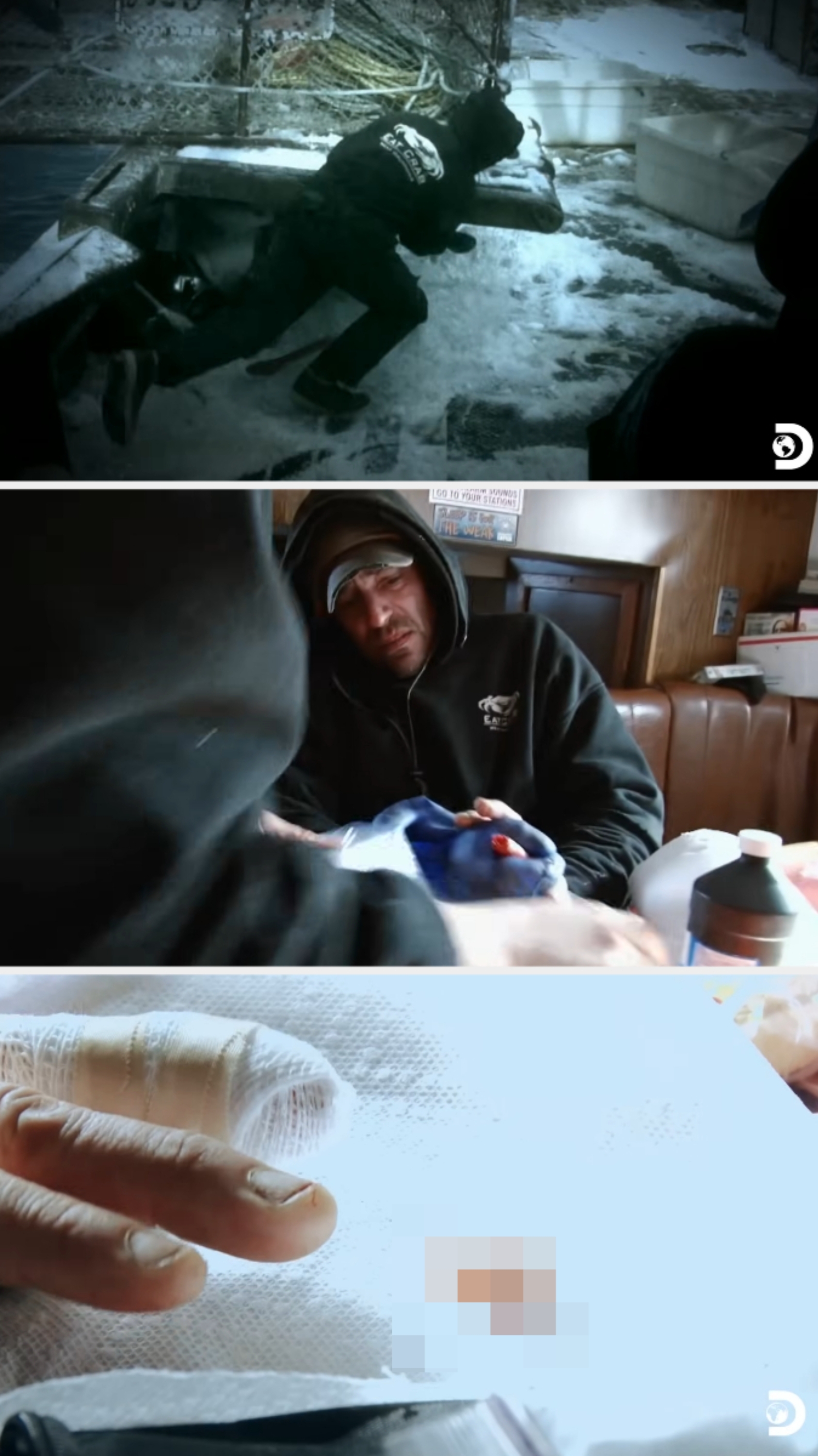 A idiosyncratic dressed successful a hoodie connected a sportfishing vessel injures their hand, receives archetypal aid, and the manus is bandaged with immoderate disposable blood