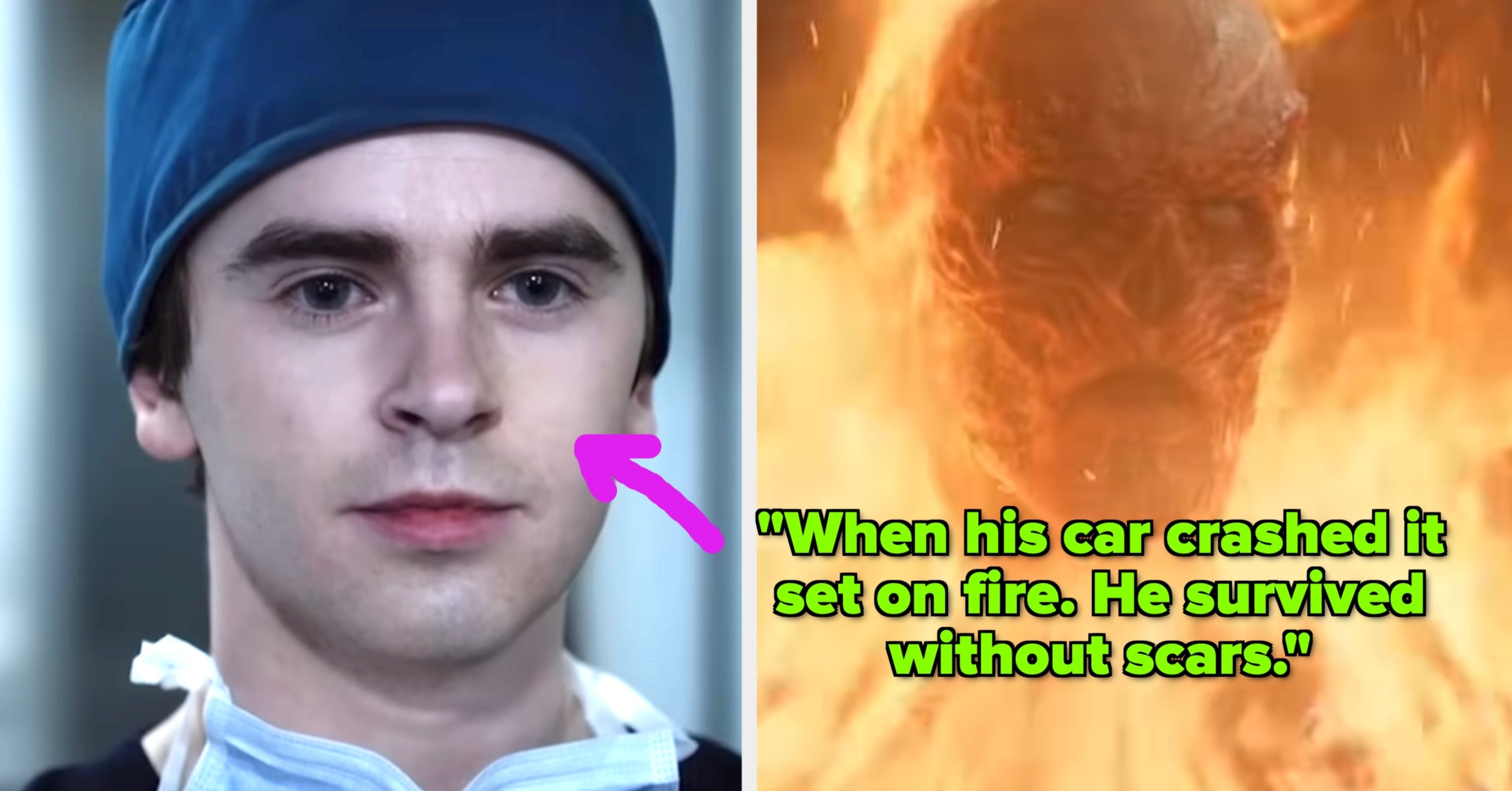 27 Brutal Medical Stories That'll Make You Say, "How The Hell Did They Survive?!"