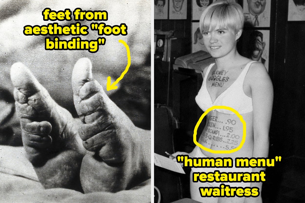 Left: Close-up of deformed feet from foot binding. Right: Waitress wearing a "human menu" tank top with food prices listed