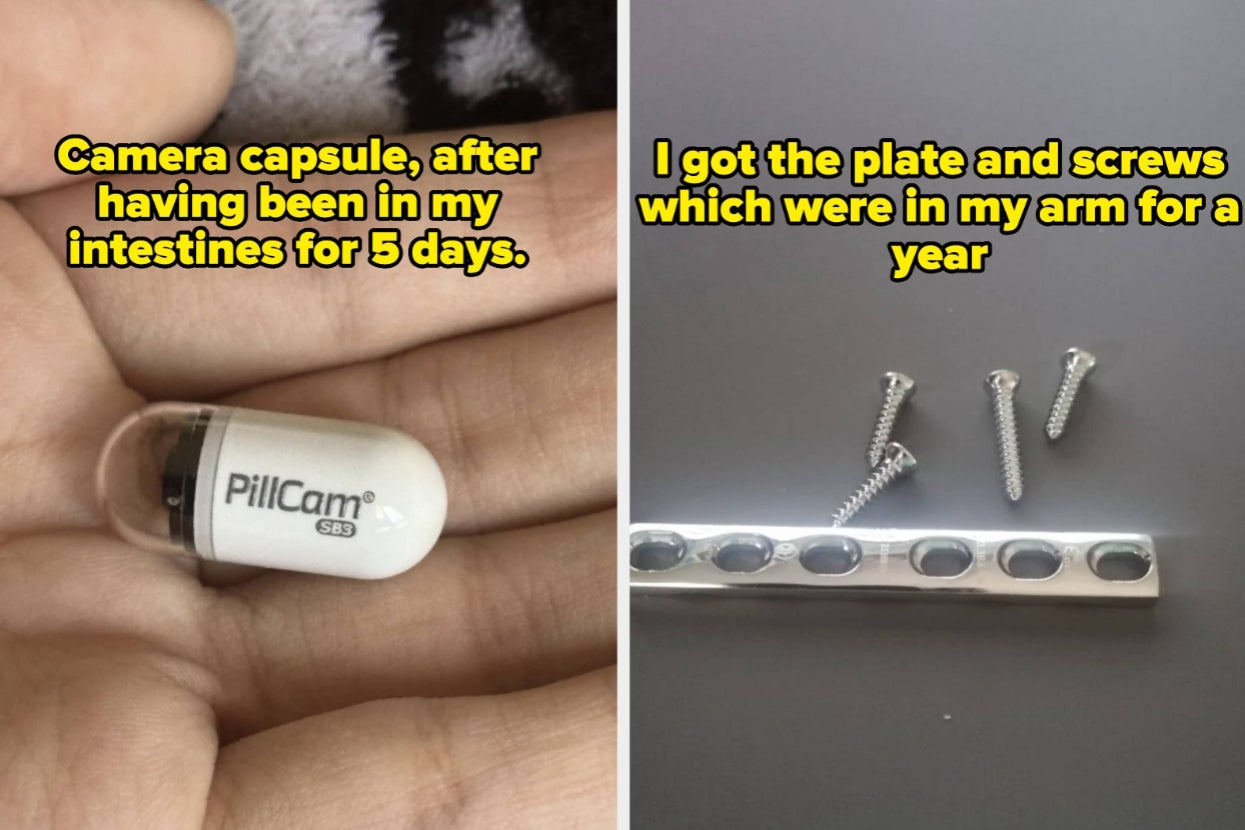 Just 51 Incredibly Fascinating Photos Of The Human Body That Have Broken My Brain