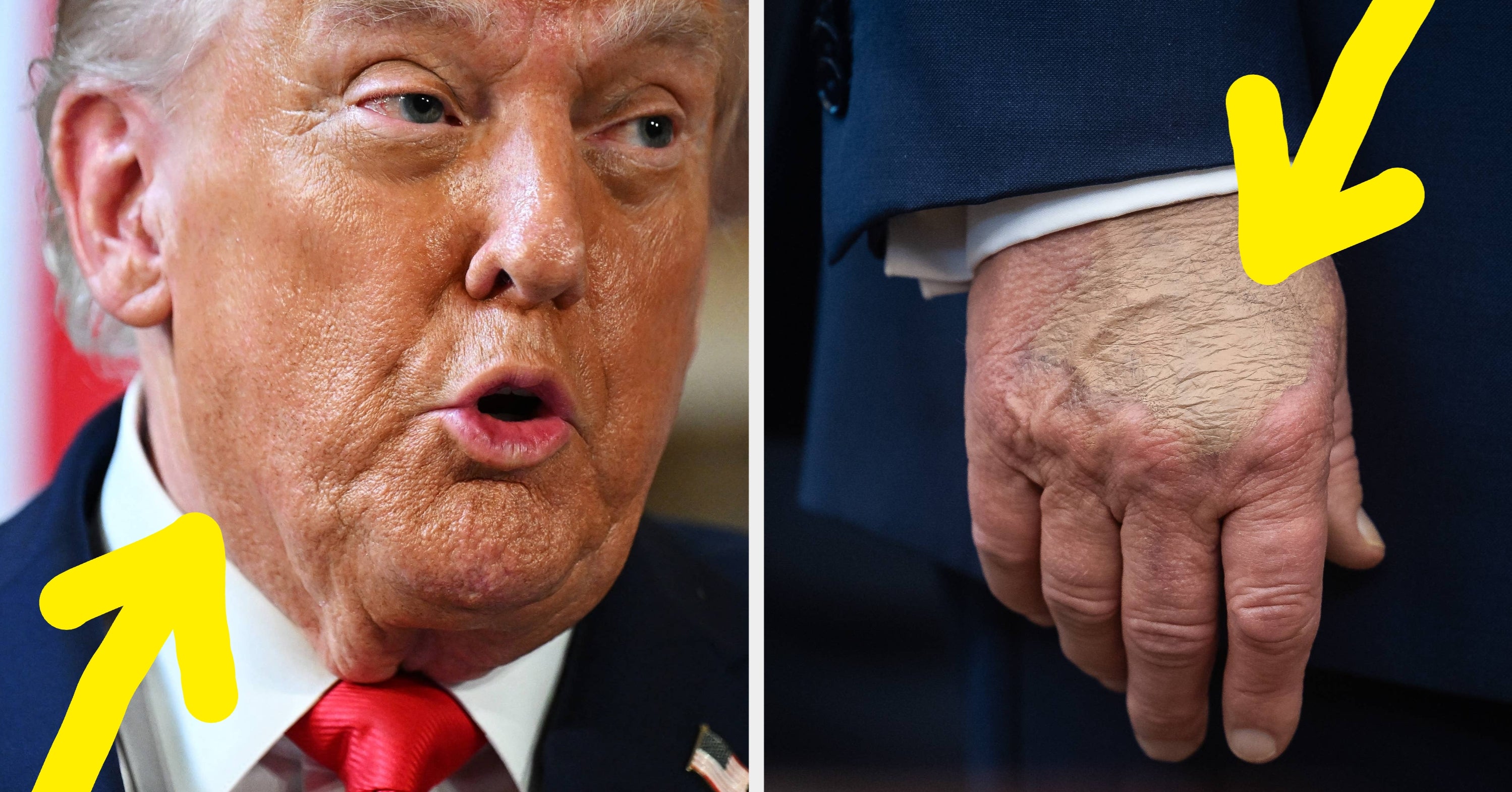 Here's What's Really Going On With Trump's Face And Hand Makeup, According To Beauty Experts