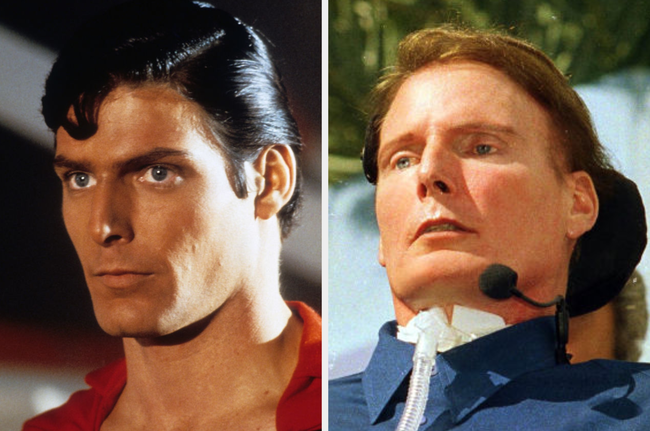 To side-ved-side bilder av en mann: venstre, som en seriøs karakter; riktig, ved hjelp av medisinsk utstyr