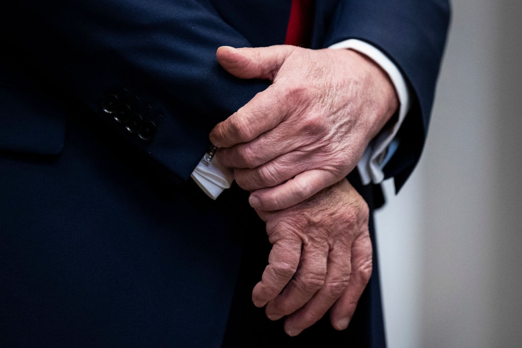 Nærbilde av en persons hender knyttet sammen, iført en formell dress