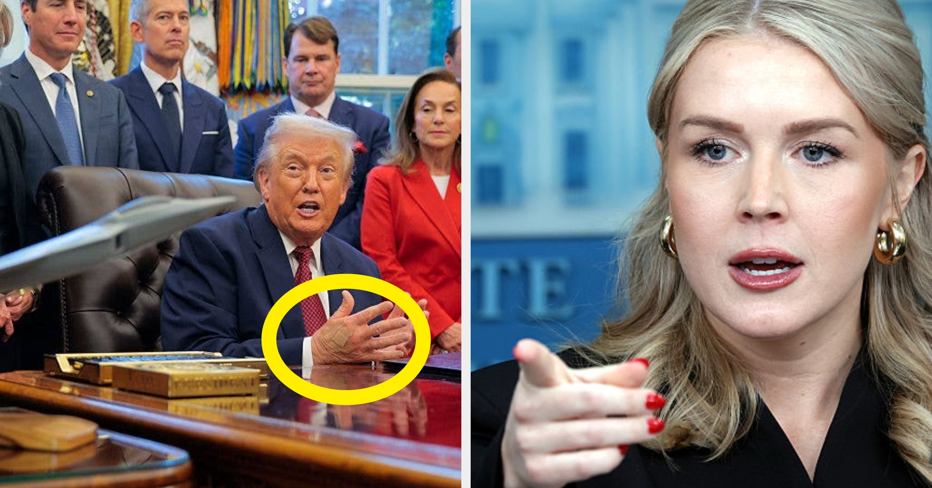 The White House Just Released A Statement About Trump's Hands And It's... Something