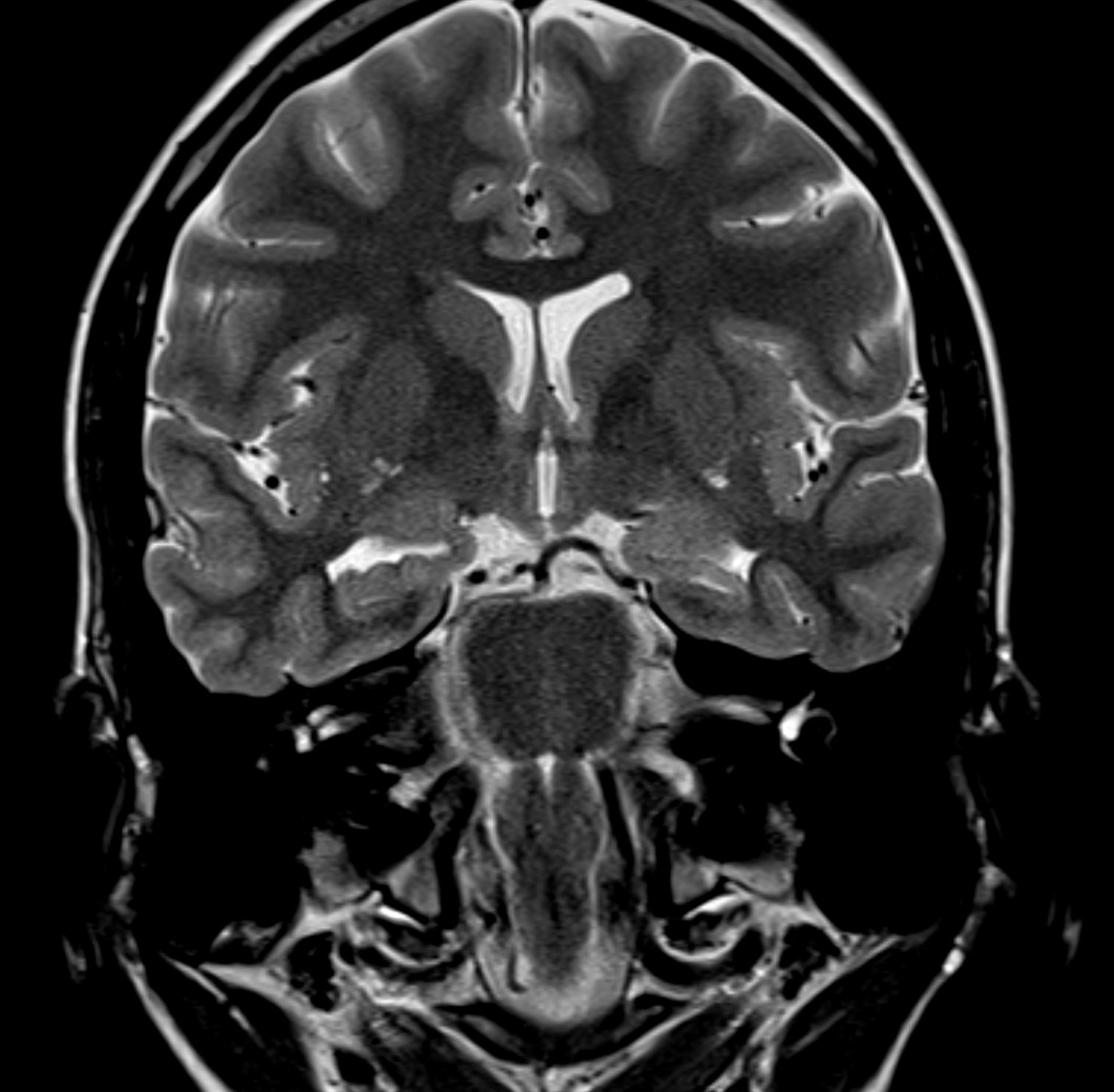 An MRI scan of a quality brain, showing elaborate cross-sectional imagery