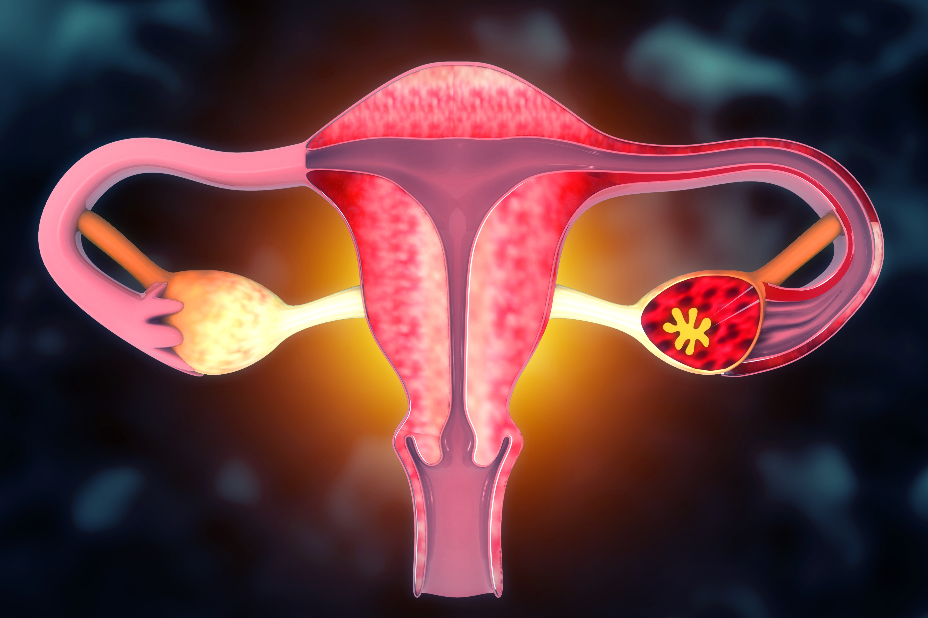 Illustration of a quality uterus with ovaries and fallopian tubes, highlighting anatomy for acquisition purposes