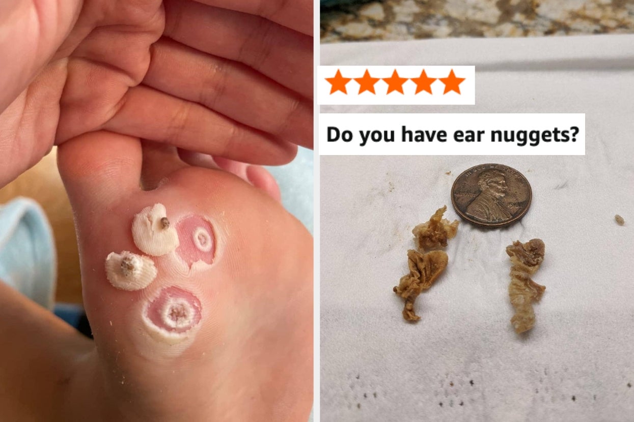 43 Things To Help You Squash Infuriating Body Issues *Before* 2026 Arrives