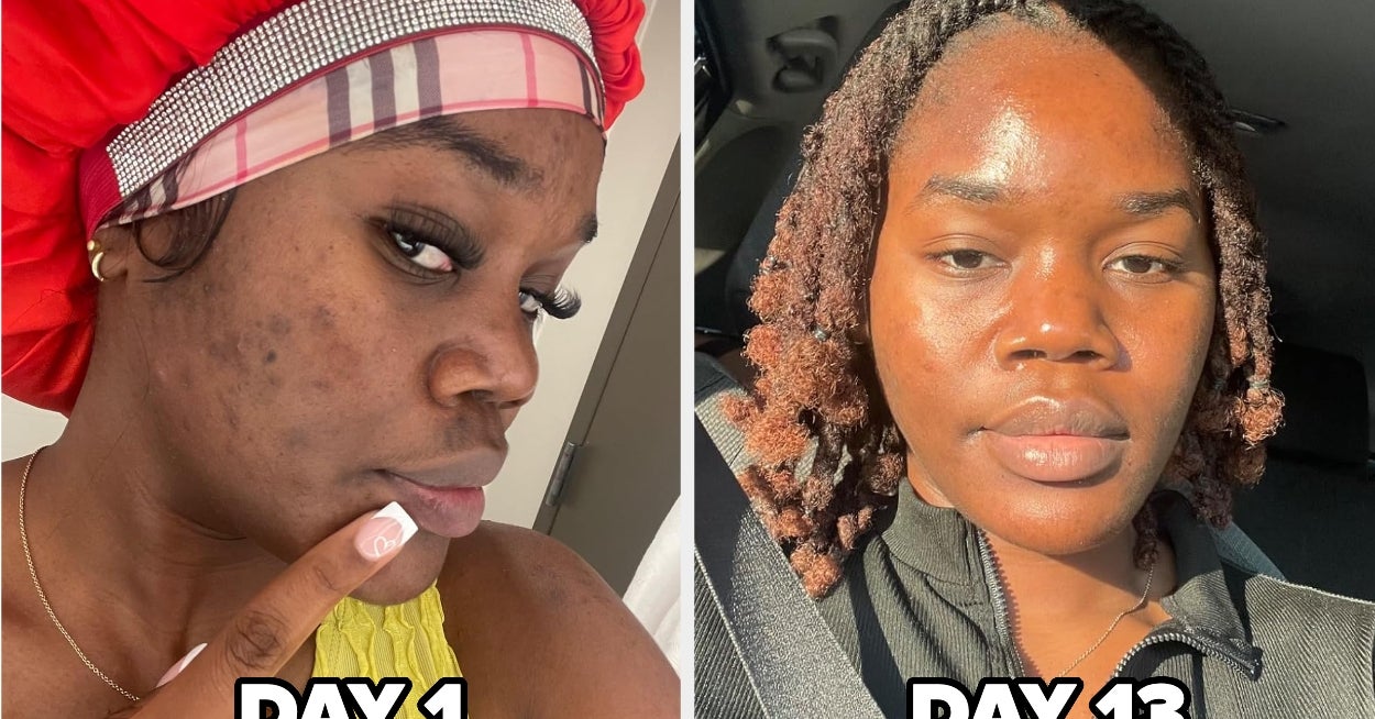 These 32 Body Care Products Have The Results To Prove They're Worth Every Penny