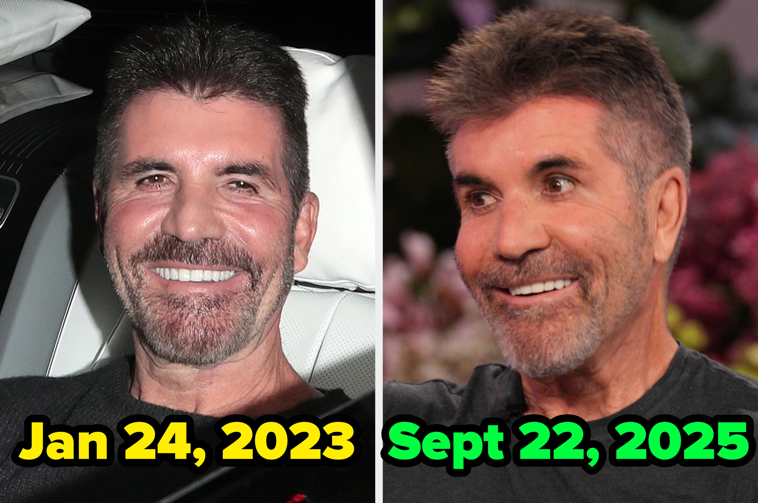 Two side-by-side images showing a man's facial transformation between January 2023 and September 2025