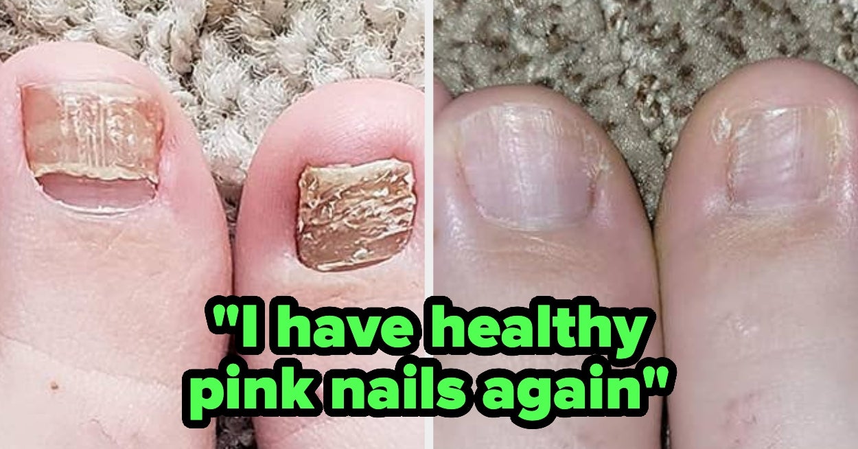 35 Products You Need So You Don't Start The New Year Whining About The Same Annoying Body Problems