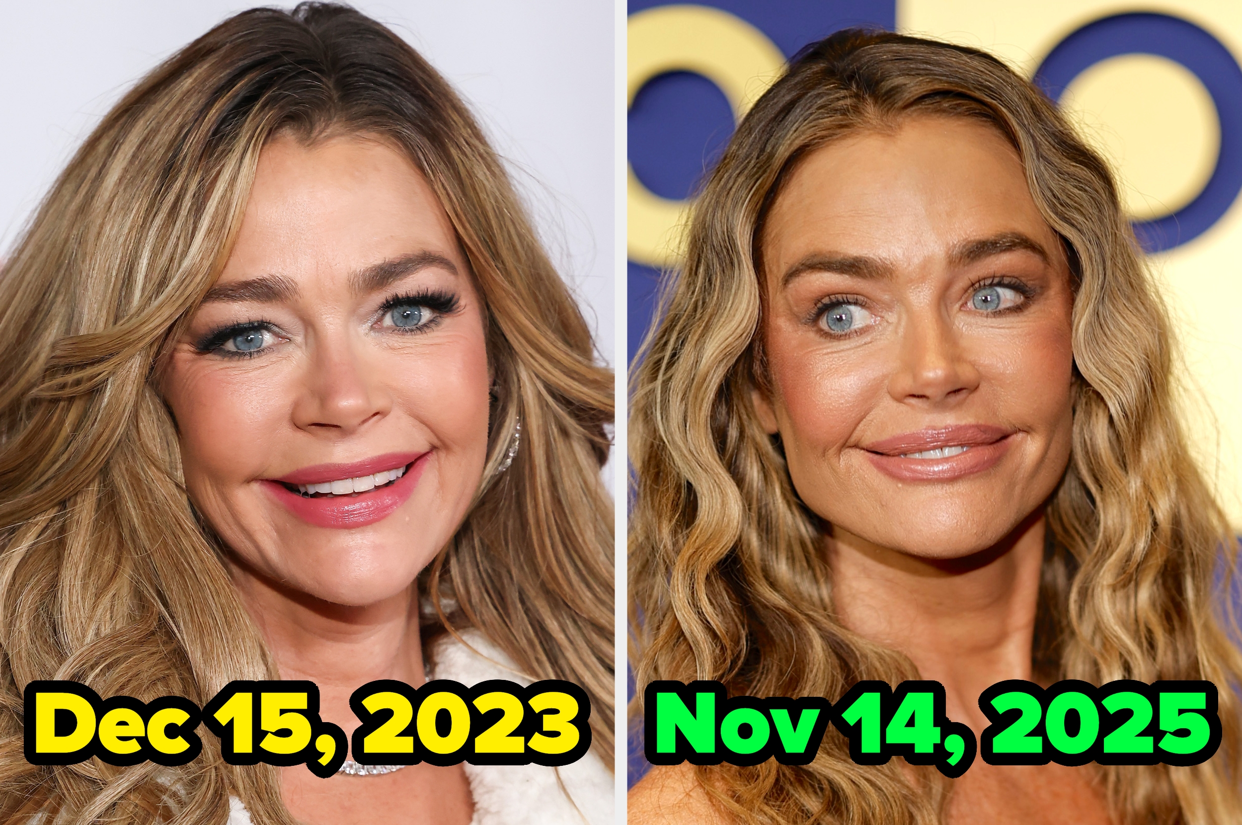 Two photos of the same person, side-by-side, dated Dec 15, 2023, and Nov 14, 2025, showing changes in appearance over time