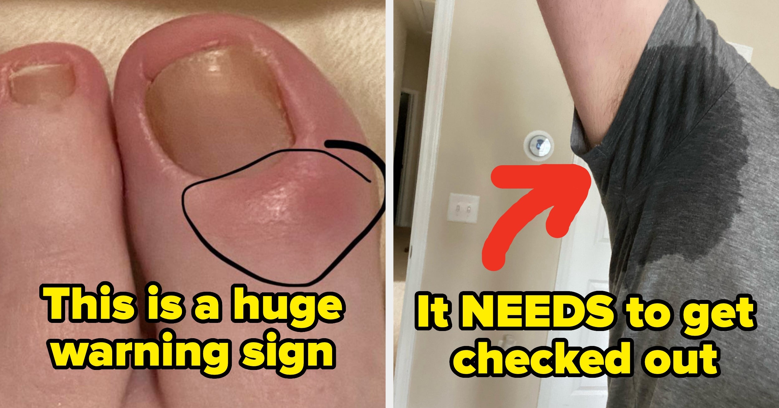 17 "Small" Health Signs You Might Be Ignoring (But They Could Be Dangerous), According To Medical Professionals