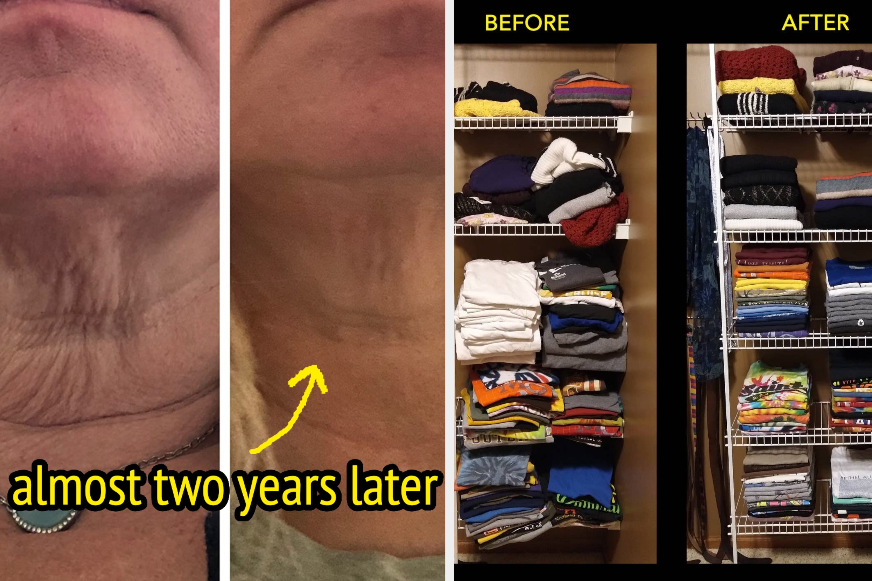 43 Products With Before & Afters That Are Almost As Shocking As The Fact That It’s Suddenly 2026