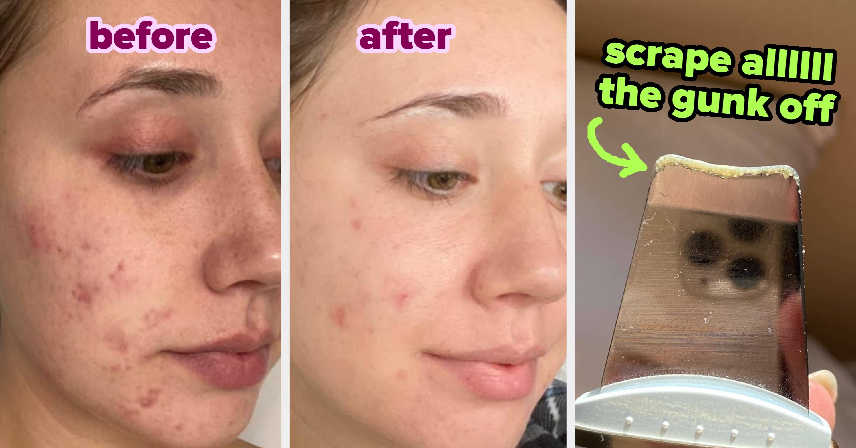 31 Skincare Products So Powerful, You Might Want To Do An Evil Cackle While Using Them