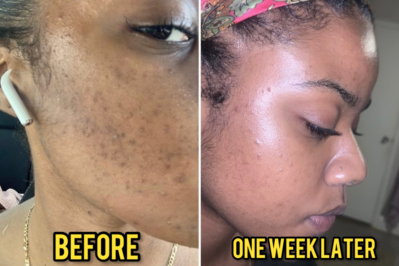 34 Skincare Products With *Exceptional* Results