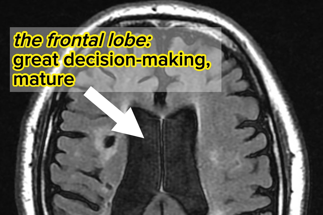 From Logical To Dreamer, Everyone Has A Dominant Brain Compartment — Here's Yours!
