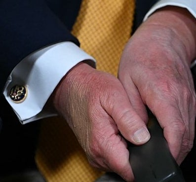 Person i dress med gullmansjettknapper og holder en TV-fjernkontroll, med fokus på hendene og antrekket