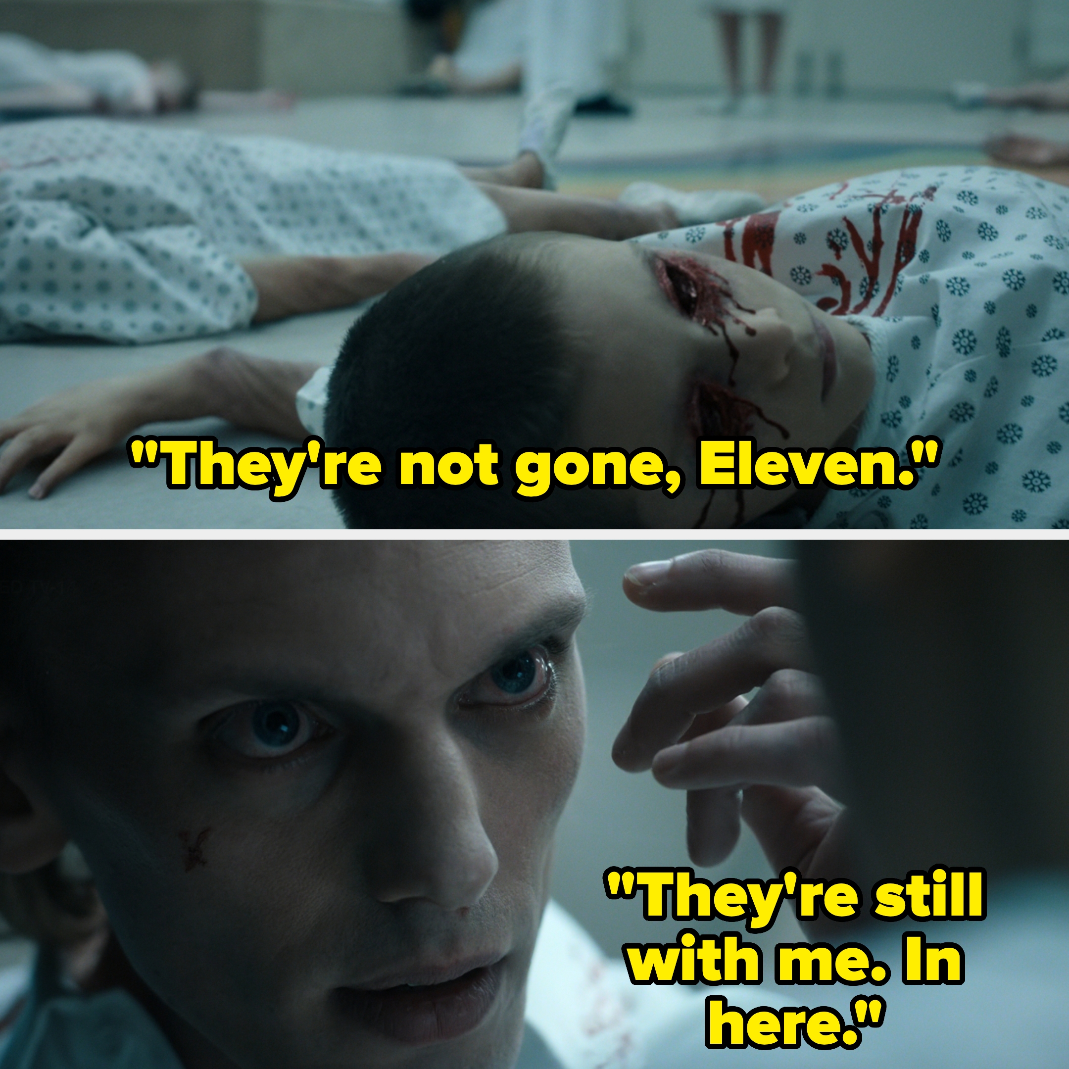  Top, a child in a hospital gown on the floor; Bottom, a person with a scarred face saying, "They're still with me. In here."