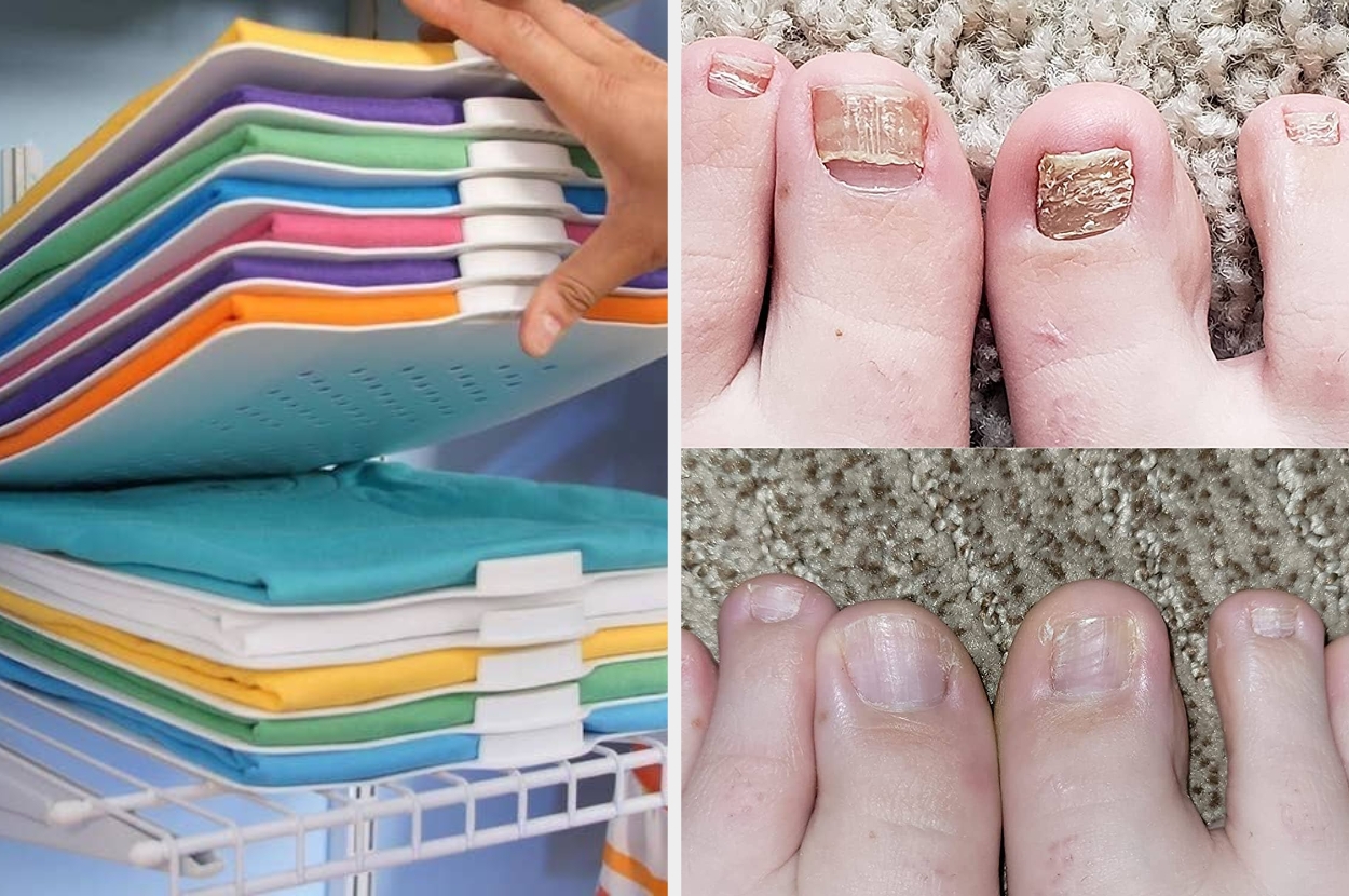 Folded shirts in neat stacks on the left; dry, cracked toenails needing care on the right