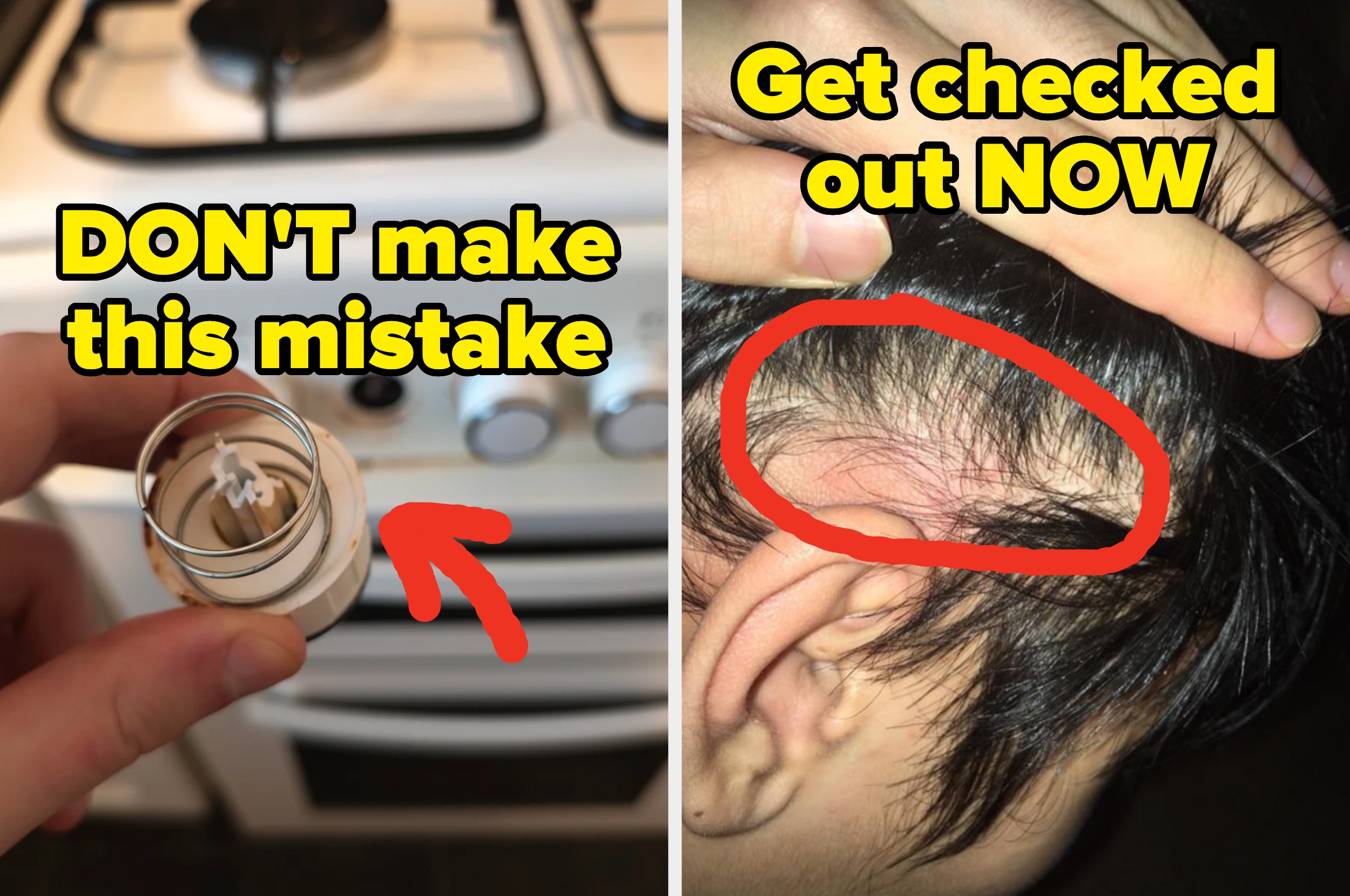 Left: Hand holding an oven knob near a stove; text: "don't make this mistake". Right: Red circle highlighting a red bump on a person's scalp with text: "get checked out now"