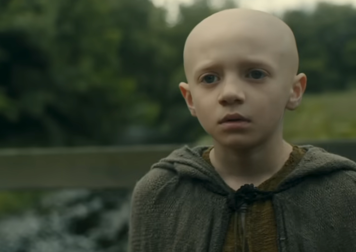 A young bald character looks concerned in an outdoor setting, wearing a simple medieval-style hoodie. Scene from a TV show or movie