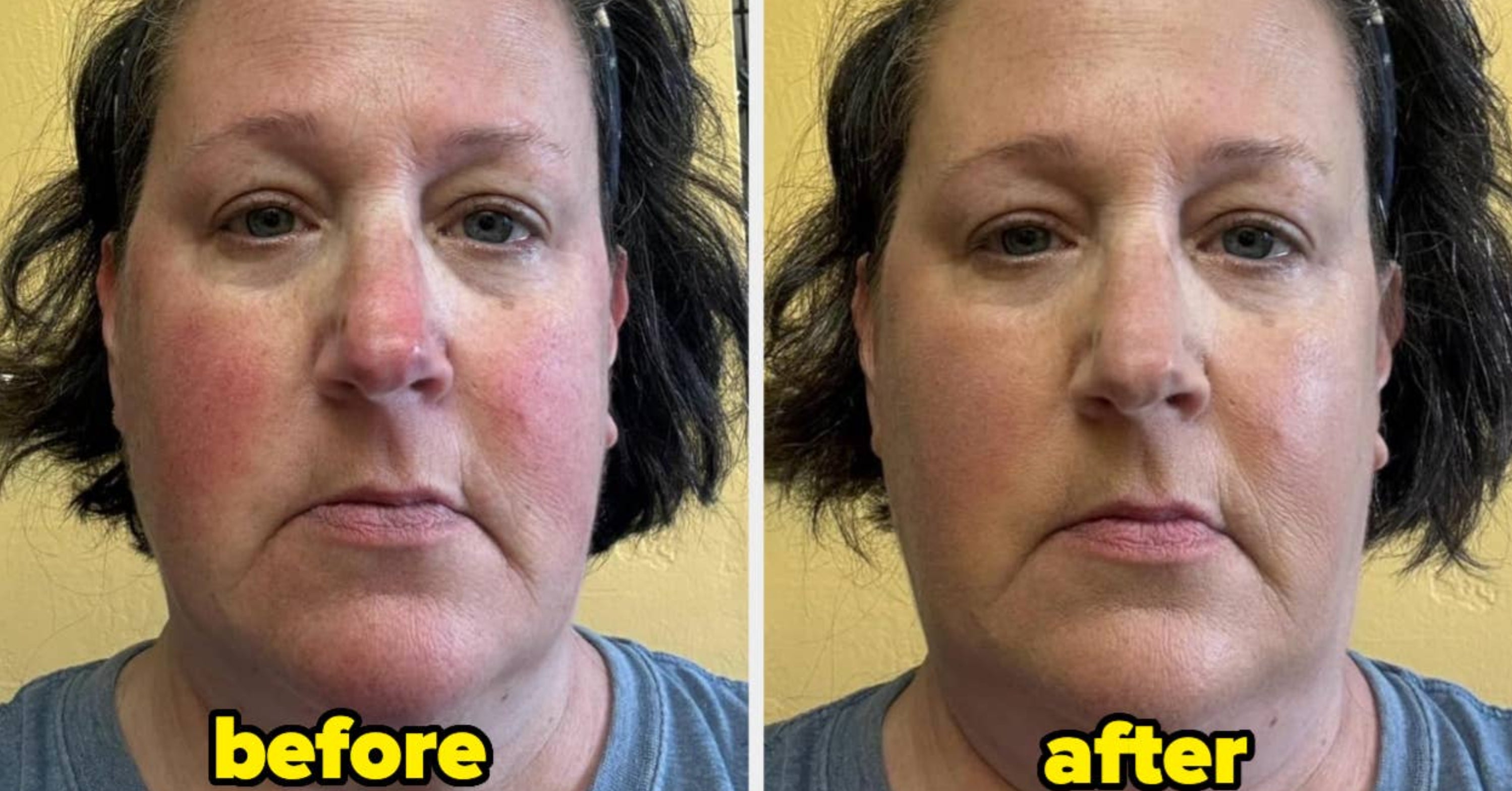 28 Products That’ll Easily Upgrade Your Skincare Routine