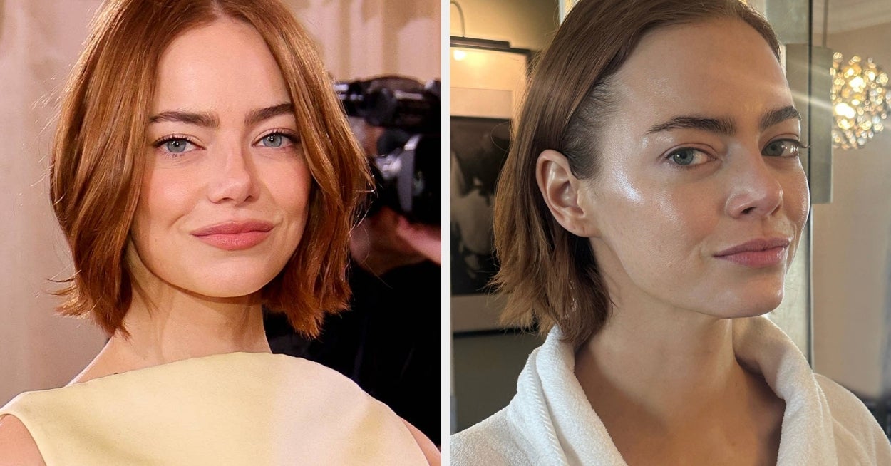 “This Is Not Filler, This Is Not Botox”: Celeb Facialist Reveals Secrets Behind Golden Globes Glow