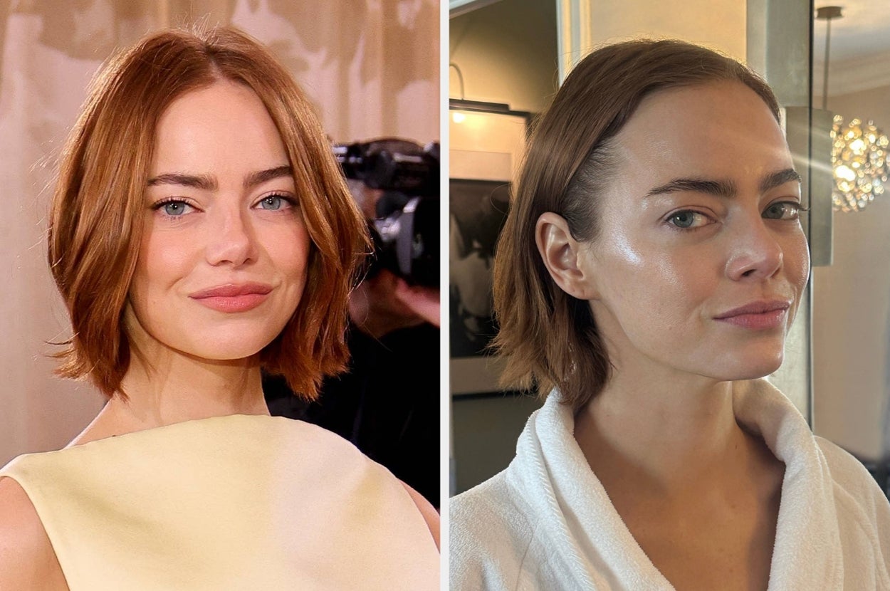 Here's What Goes Into A $3,000 Awards Season Facial, That Most Celebs You've Heard Of Have Probably Gotten