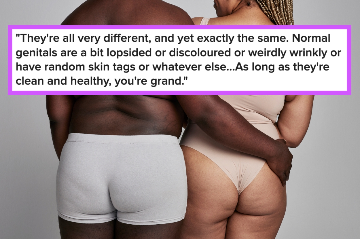 Two people in underwear stand together, arms around each other, with text above discussing the normal variation in genital appearance