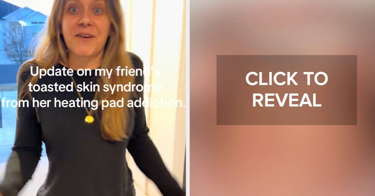 This Woman's Heating Pad Horror Story Has Left Nearly 50 Million People Stunned