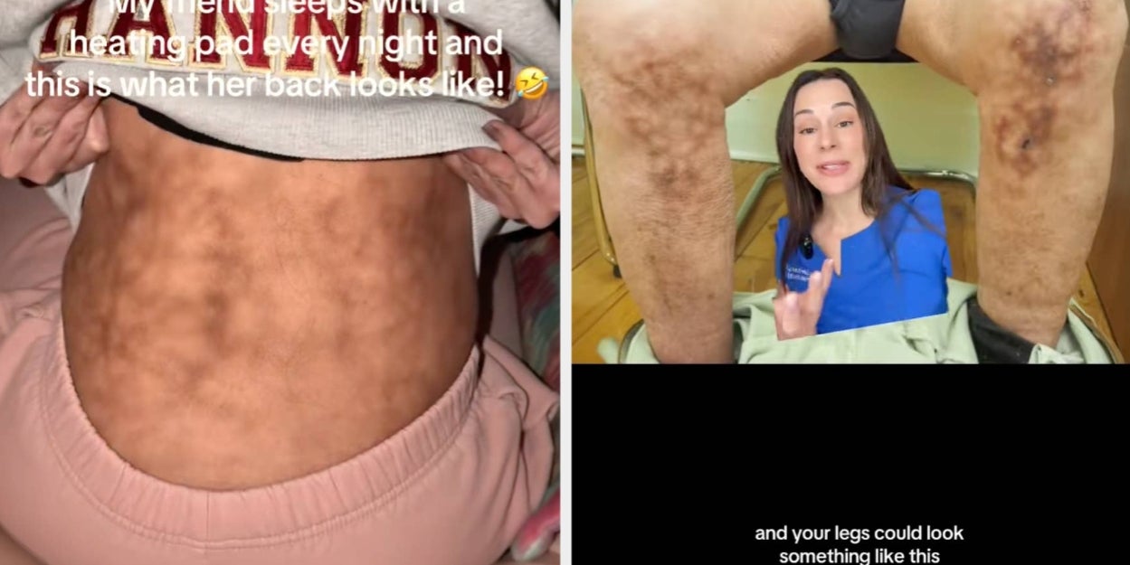 Nearly 50 million people just found out what heating pads can do to your body and now they're throwing theirs away