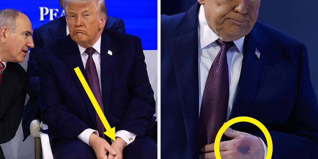 The Latest Photo Of Trump’s Other Hand Is Seriously Hard To Unsee