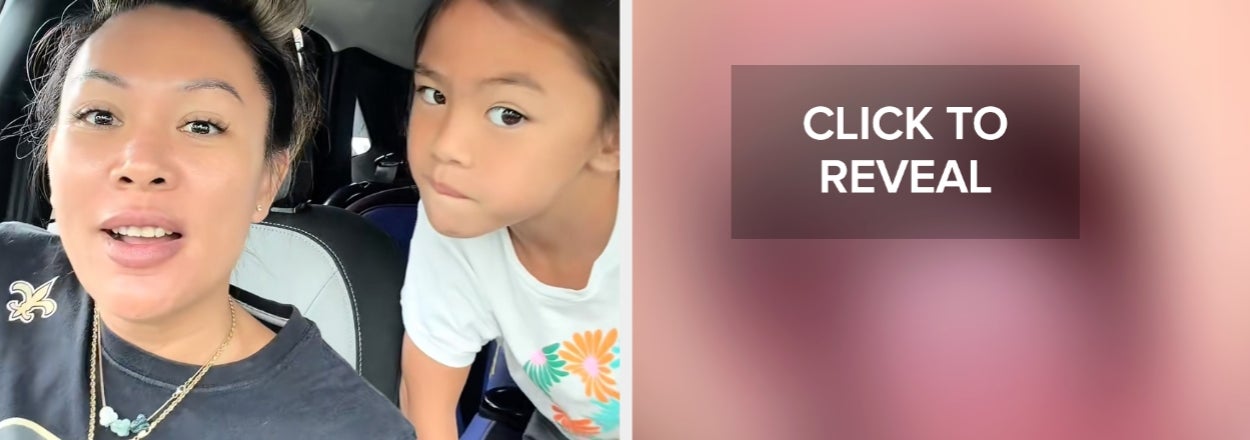 "My Poor Girl Now Walks Around Telling People She’s A Piranha": This Mom Is Warning Parents With Kids Who Suck Their Thumbs About "Tongue Cribs," And People Are Losing It After Seeing This Frightening Device