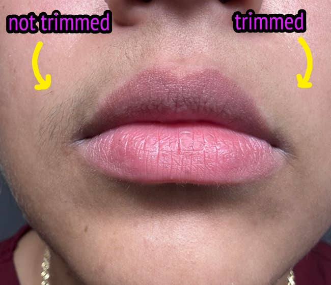 Close-up of a person's upper lip showing a comparison between a trimmed and untrimmed area, highlighting different grooming results