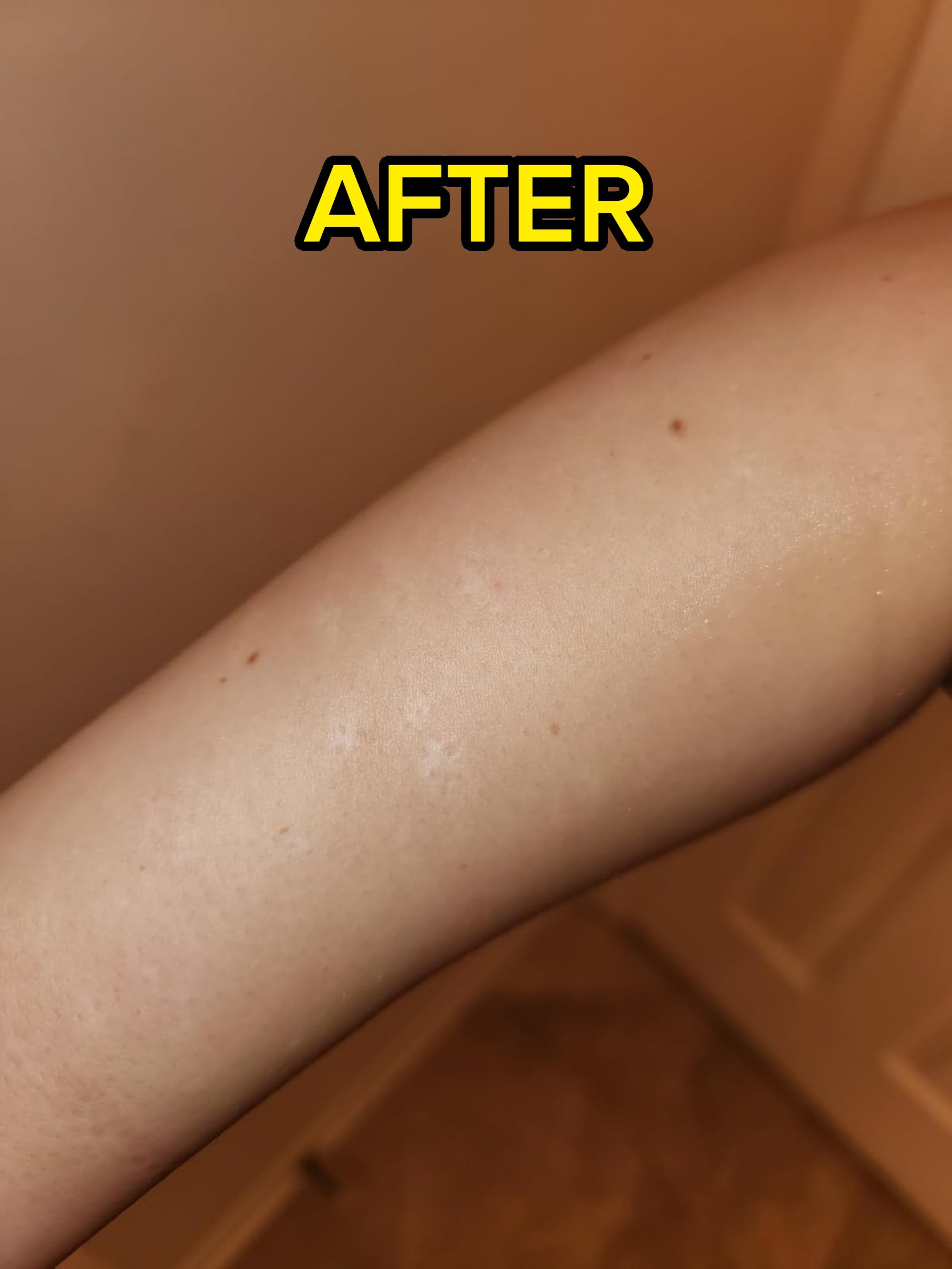 Close-up of a person's upper arm, highlighting smooth, hairless skin texture