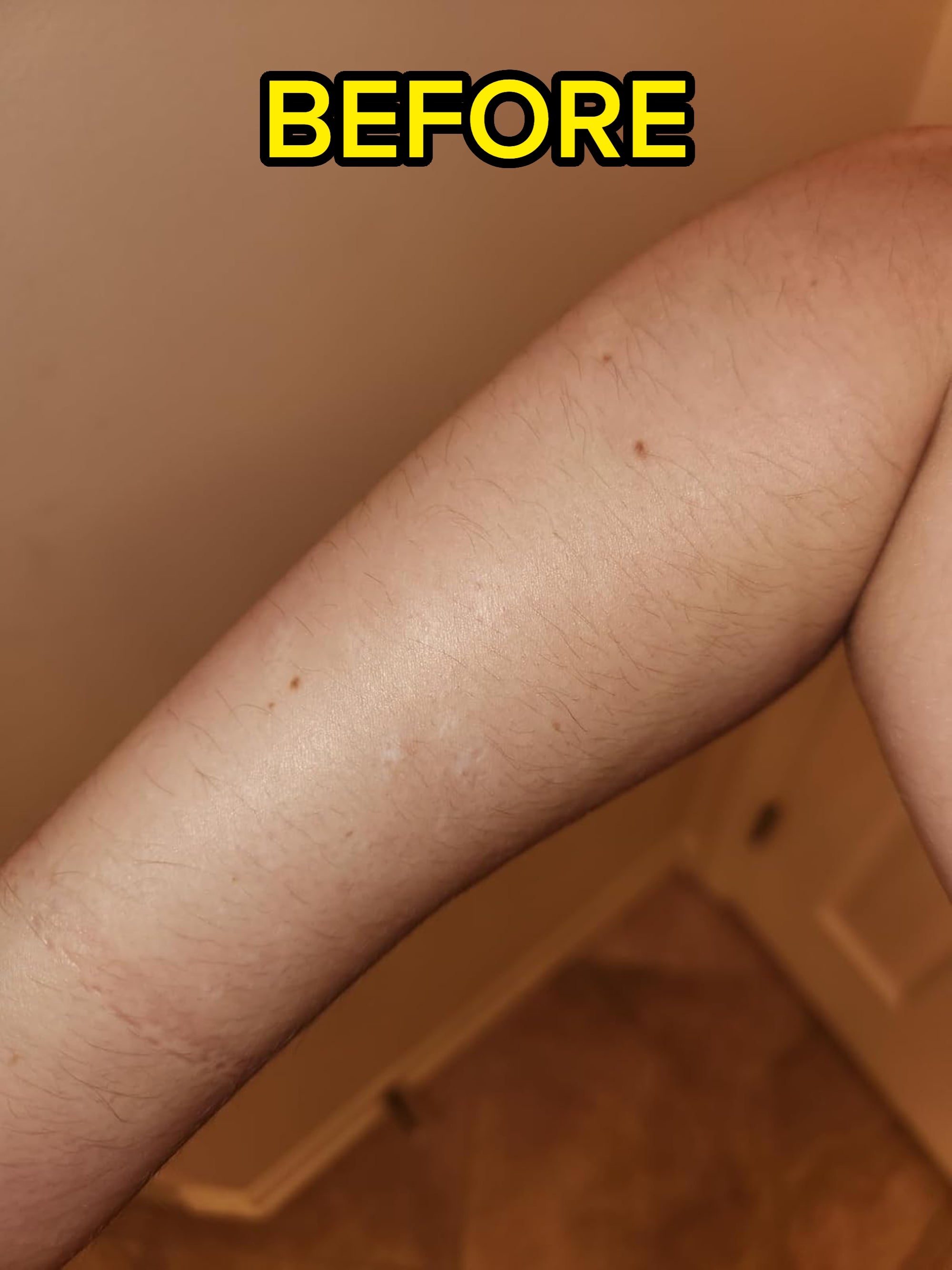 Close-up of an arm showing hair and skin texture