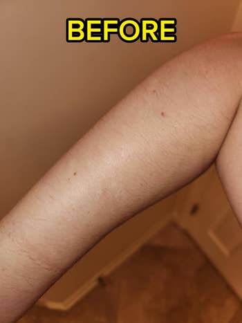 Close-up of an arm showing hair and skin texture