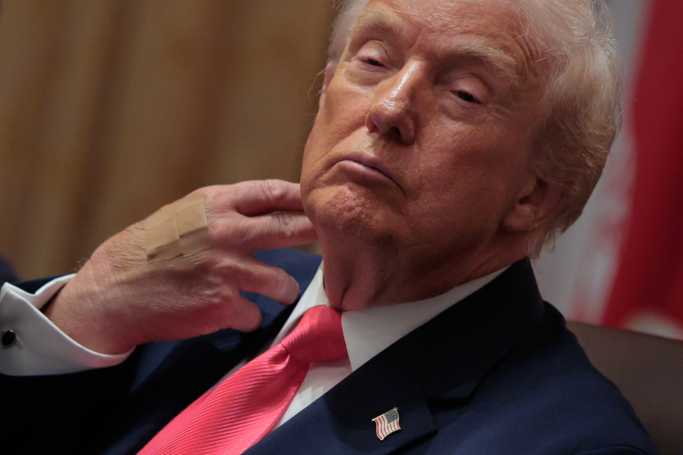 A person in a suit with a bandage on their hand raises it to their neck, seated indoors, appearing thoughtful or contemplative