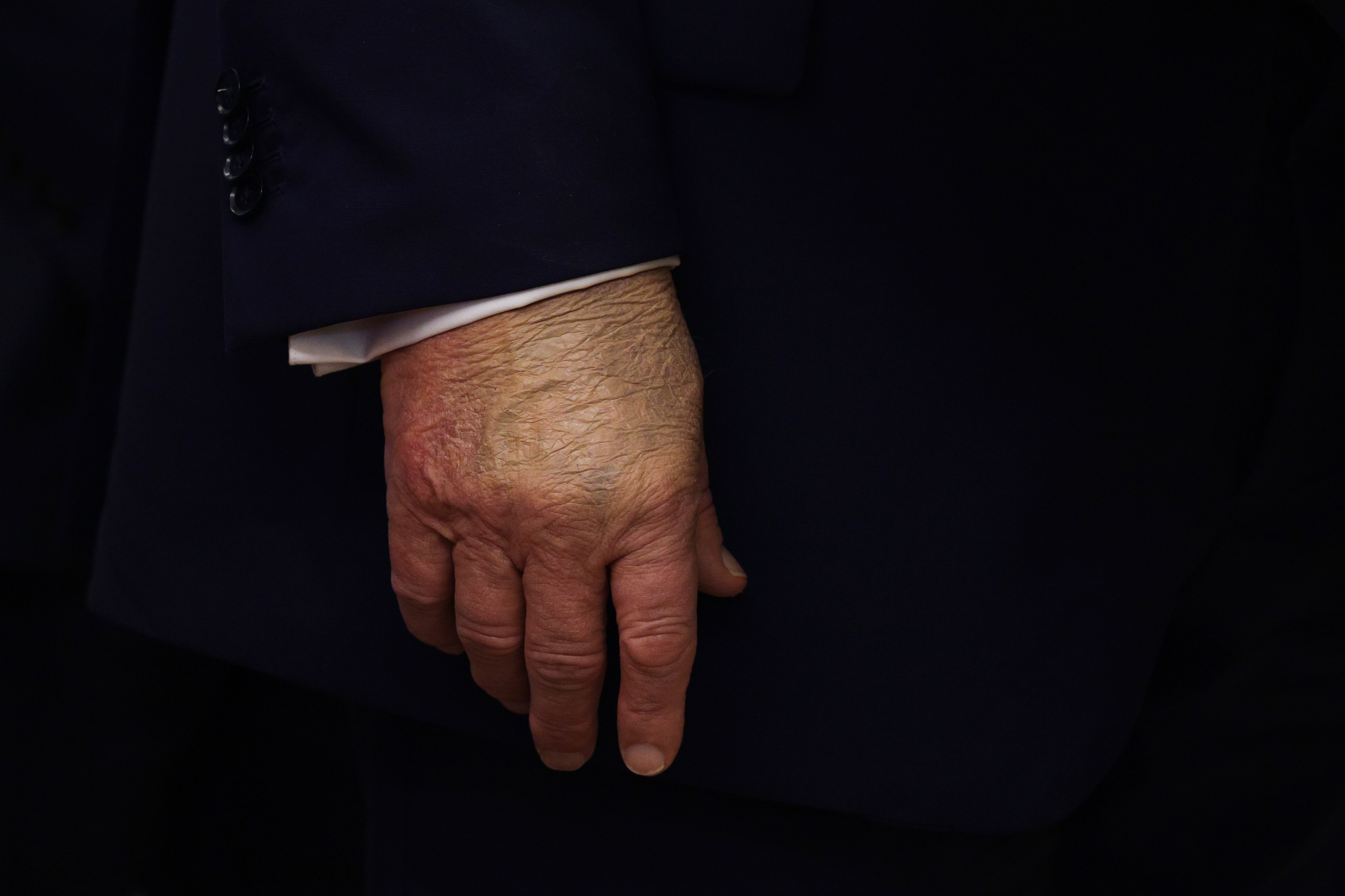 Close-up of a person's hand in a suit jacket sleeve, fingers relaxed