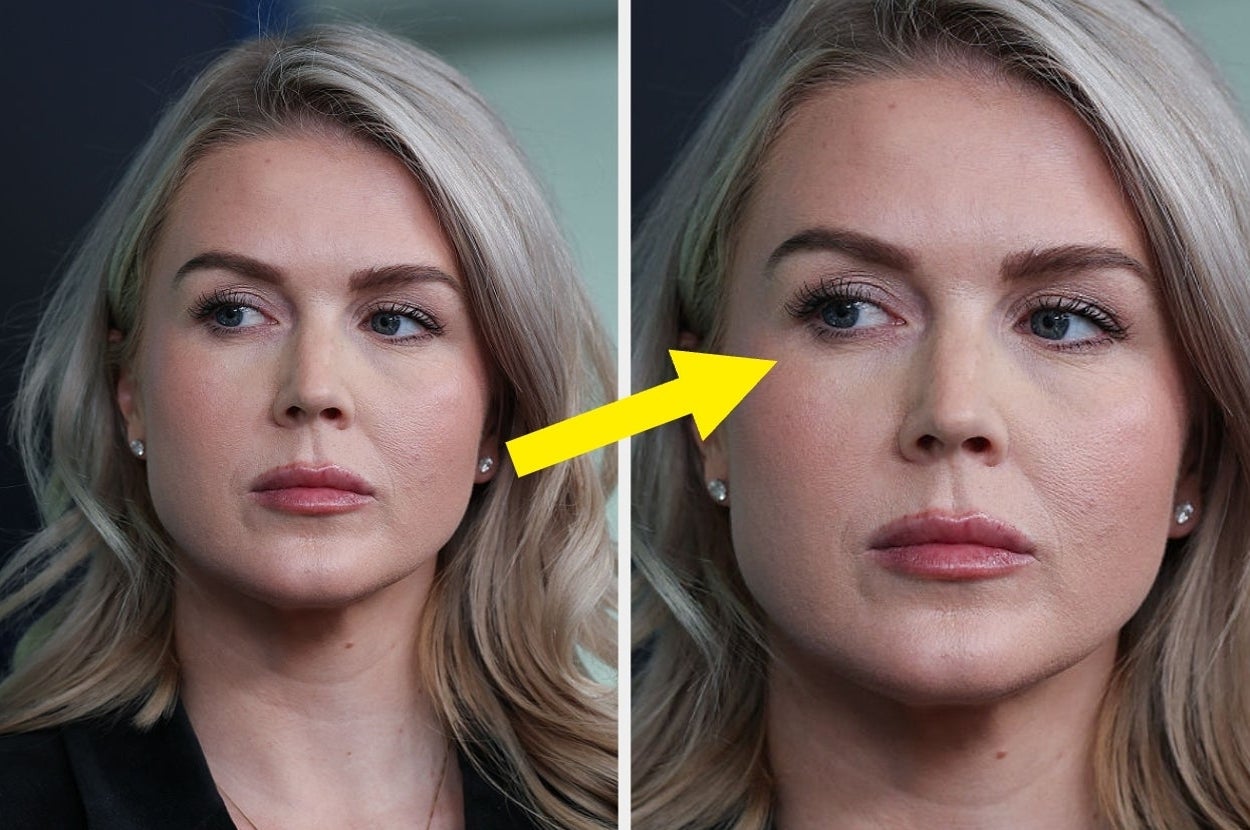 Woman in two close-up photos, slightly looking to the side; an arrow points from left image to the right image