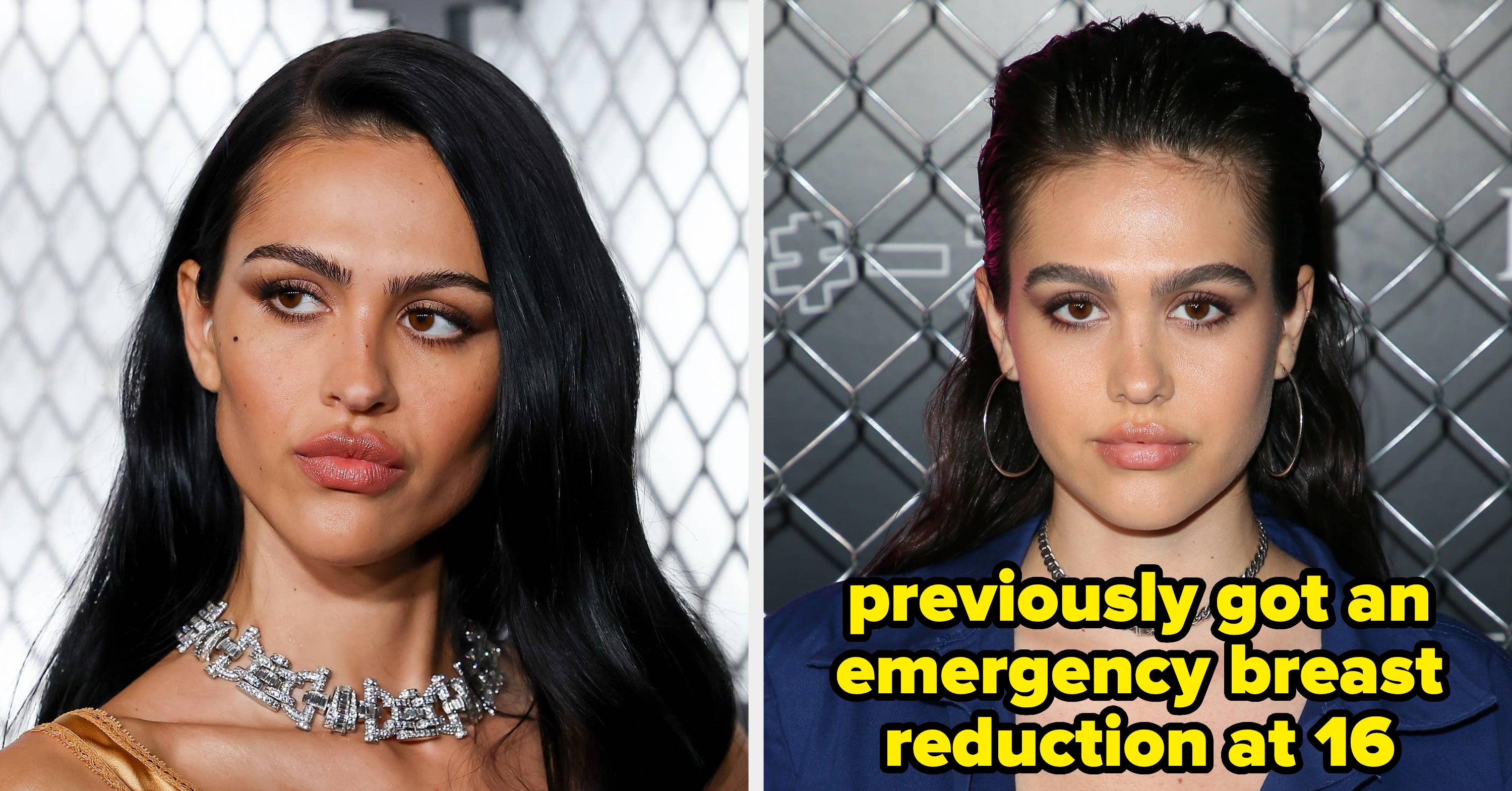 Amelia Gray Hamlin Details Painful Aftermath Of Breast Augmentation Mishap