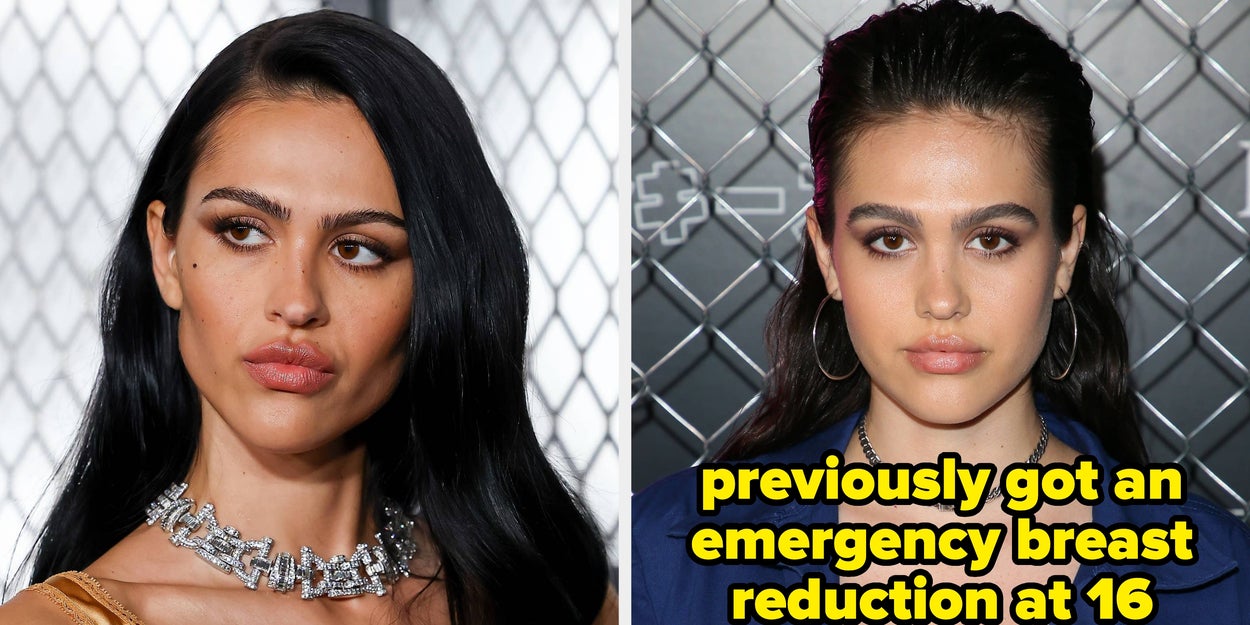 Amelia Gray Hamlin Detailed The Aftermath Of A Breast Augmentation That Went Horrifically Wrong