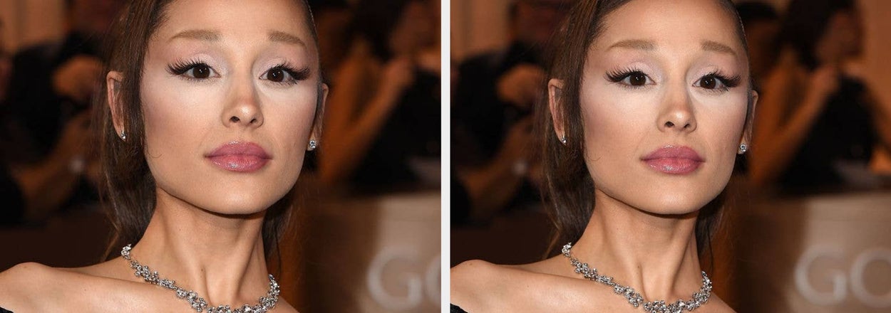 The Latest Version Of Celebrity Thinness Isn’t Just Annoying, It’s Dangerous. I Should Know.
