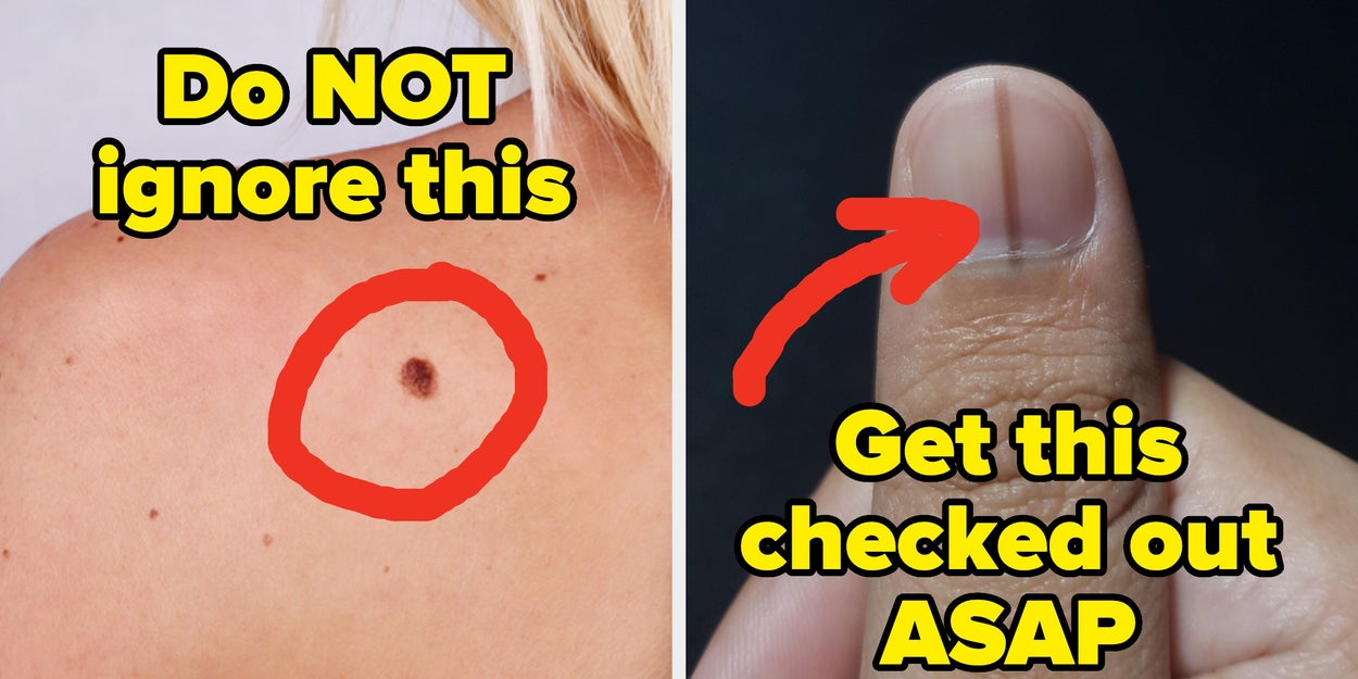 15 Health Warning Signs You Should Never, Ever Ignore, Straight From Doctors And Nurses