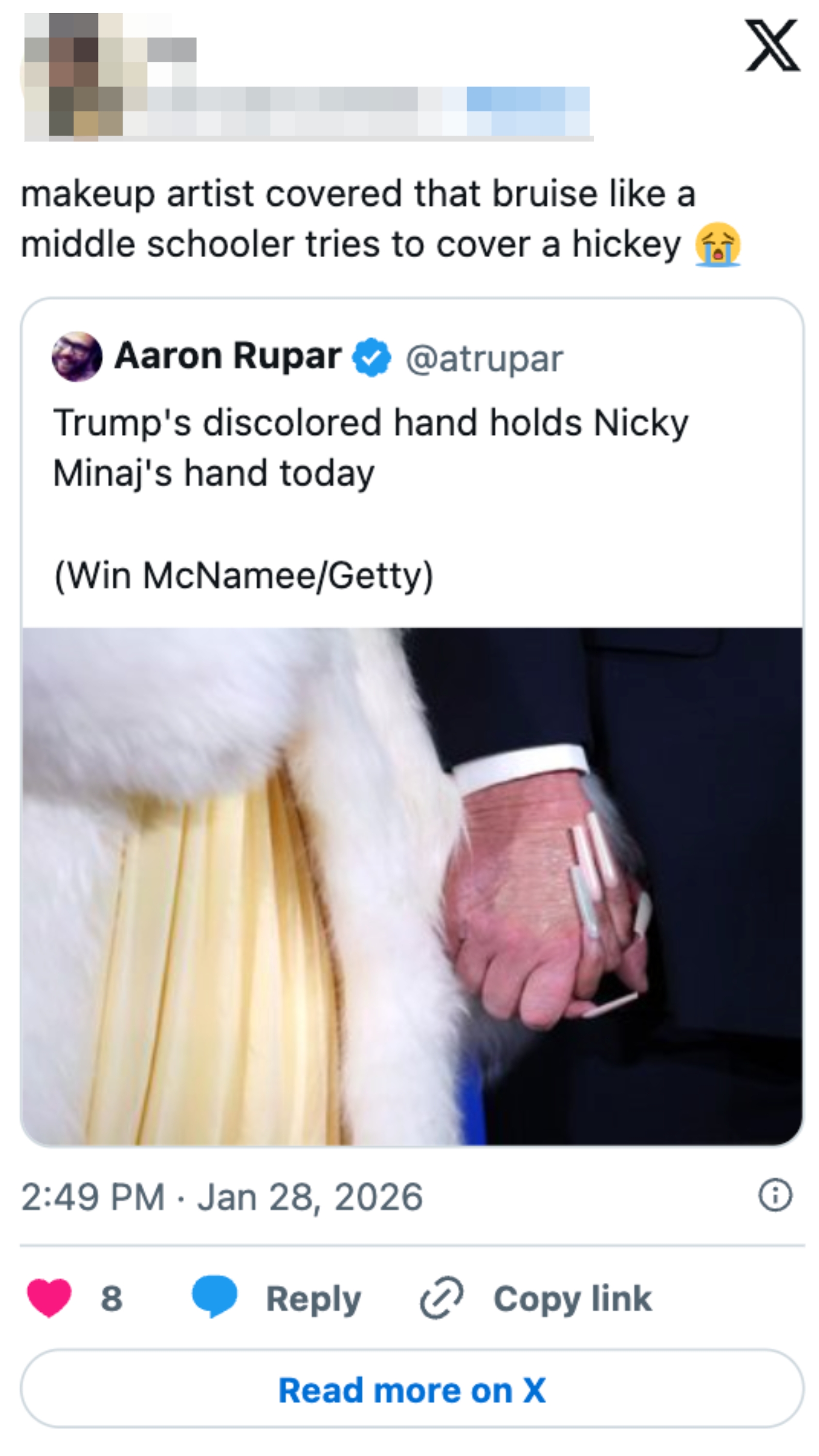 Tweet av Aaron Rupar viser Trumps misfargede hånd som holder en annen hånd, kommentarer på sminke som dekker den som en ungdomsskoleelevs hickey